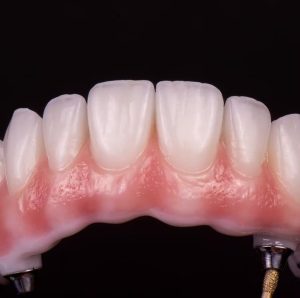 imgi_28_0e2eb9_c9621c80fcef42718d72c5575df896cemv2-300x298